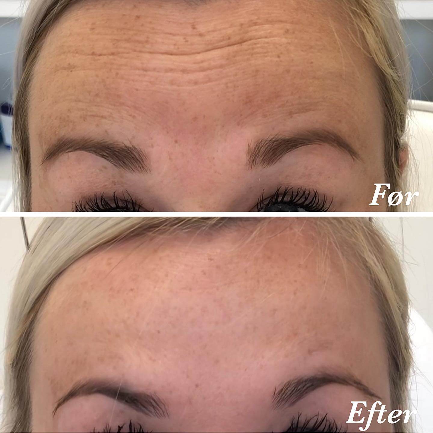 før-efter-1