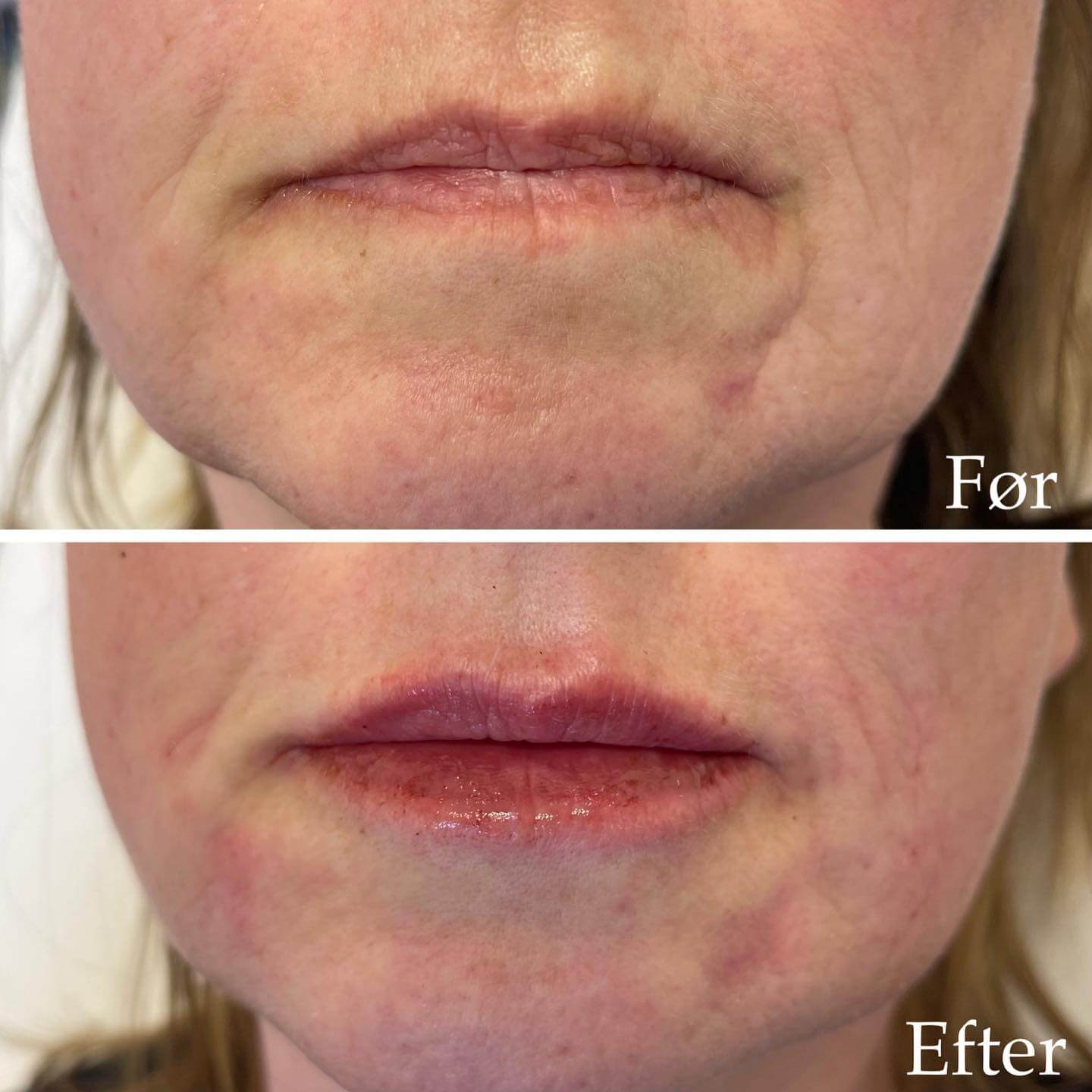 før-efter-3